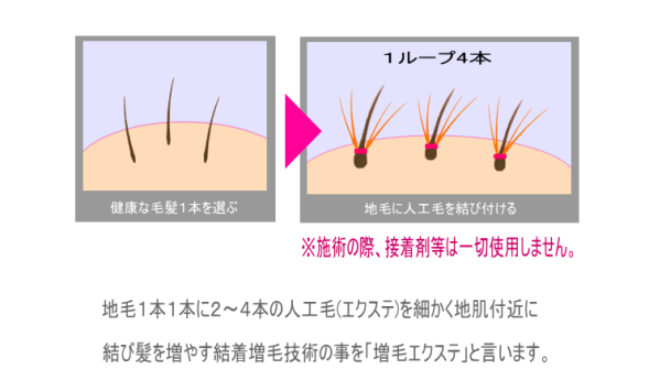 １ループ４本※施術の際、接着剤等は一切使用しません。地毛１本１本に２～４本の人工毛(エクステ)を細かく地肌付近に結び髪を増やす結着増毛技術の事を「増毛エクステ」と言います。